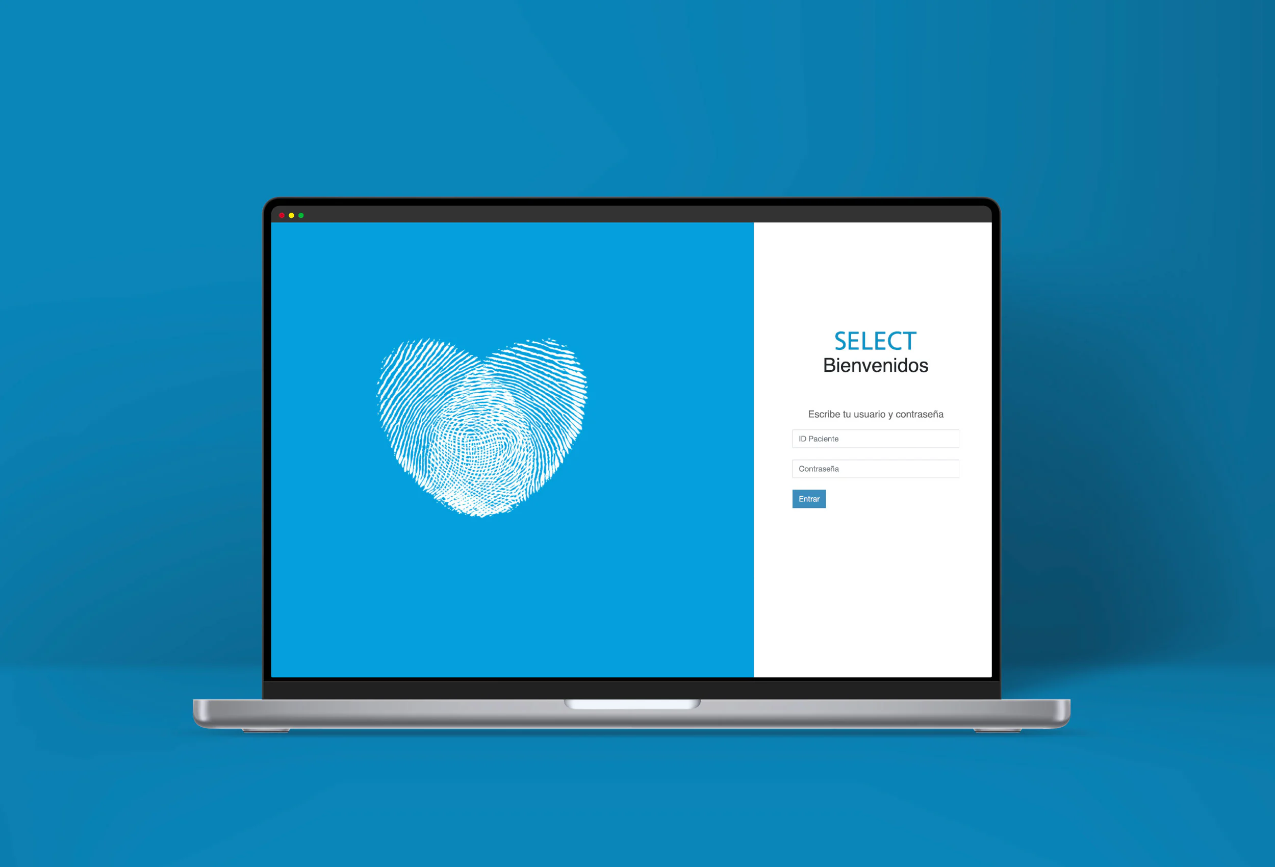 Select MX — 1